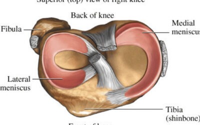 Spotlight on… Cartilage Tears in the Knee